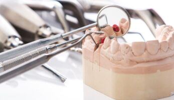 Periodontoloji